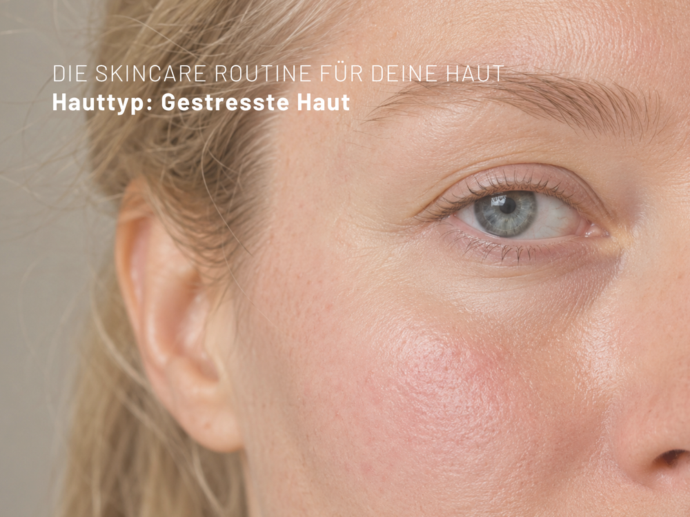 Gestresste Haut